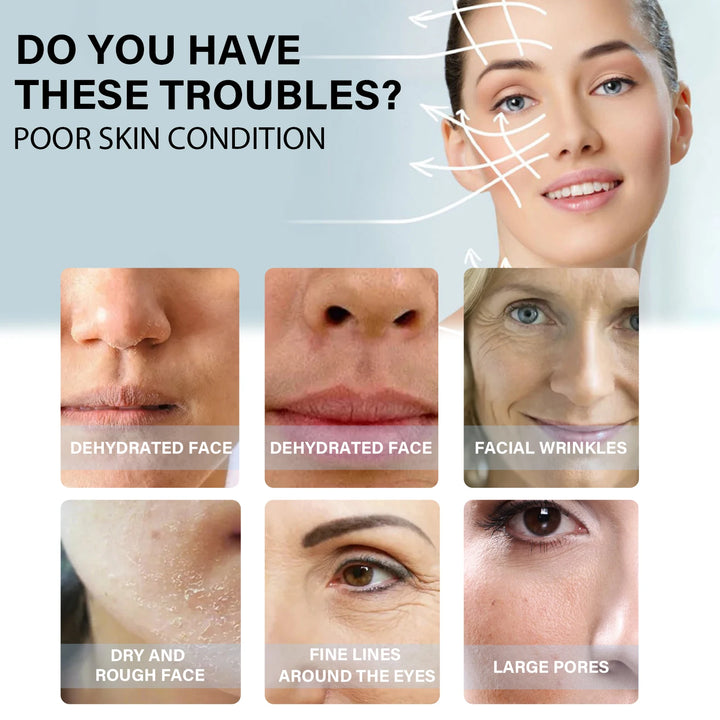 Hilos Faciales de Colágeno Dorado 60 pcs – Efecto Lifting Sin Agujas