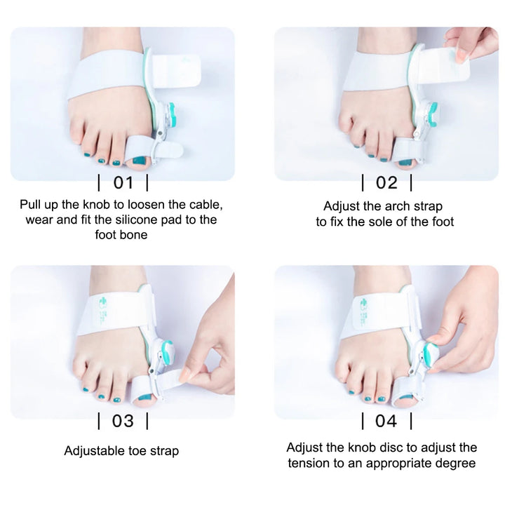 Corrector de Juanetes Ajustable - Alivio del Dolor y Corrección de Hallux Valgus | Ortopédico