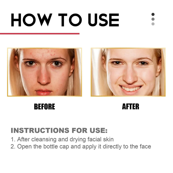 Bloqueador Solar Mate – Protector Facial UV con Hidratación, Control de Grasa y Efecto Aclarante