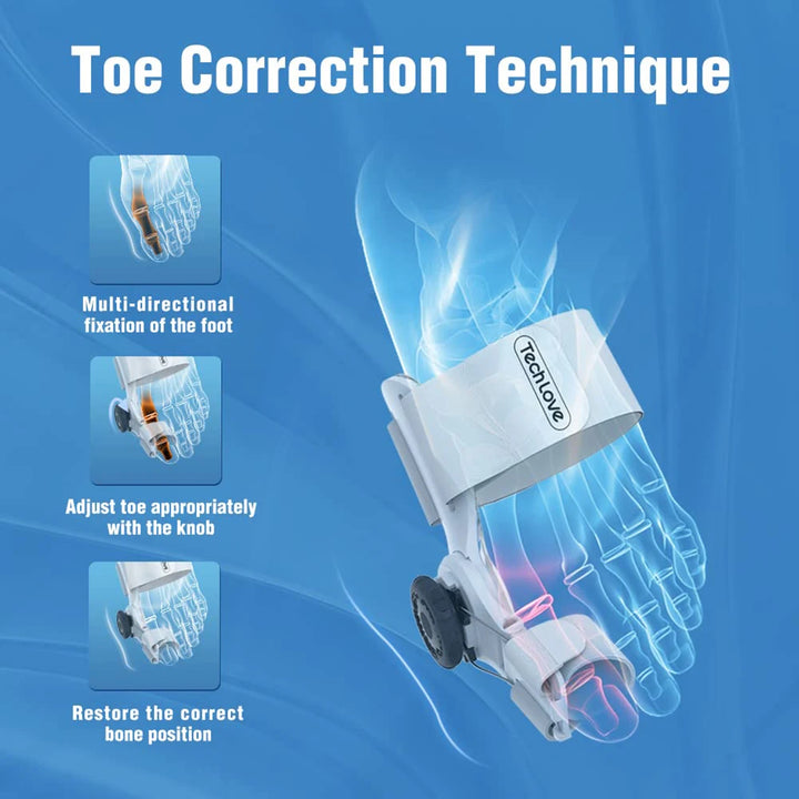 Corrector de Juanetes Ajustable - Alivio del Dolor y Corrección de Hallux Valgus | Ortopédico